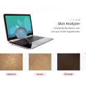 New Model Portable Skin Analyzer